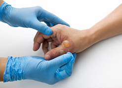 Blisters and Infections